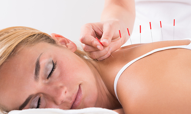 AcupuncTherapie-Massage