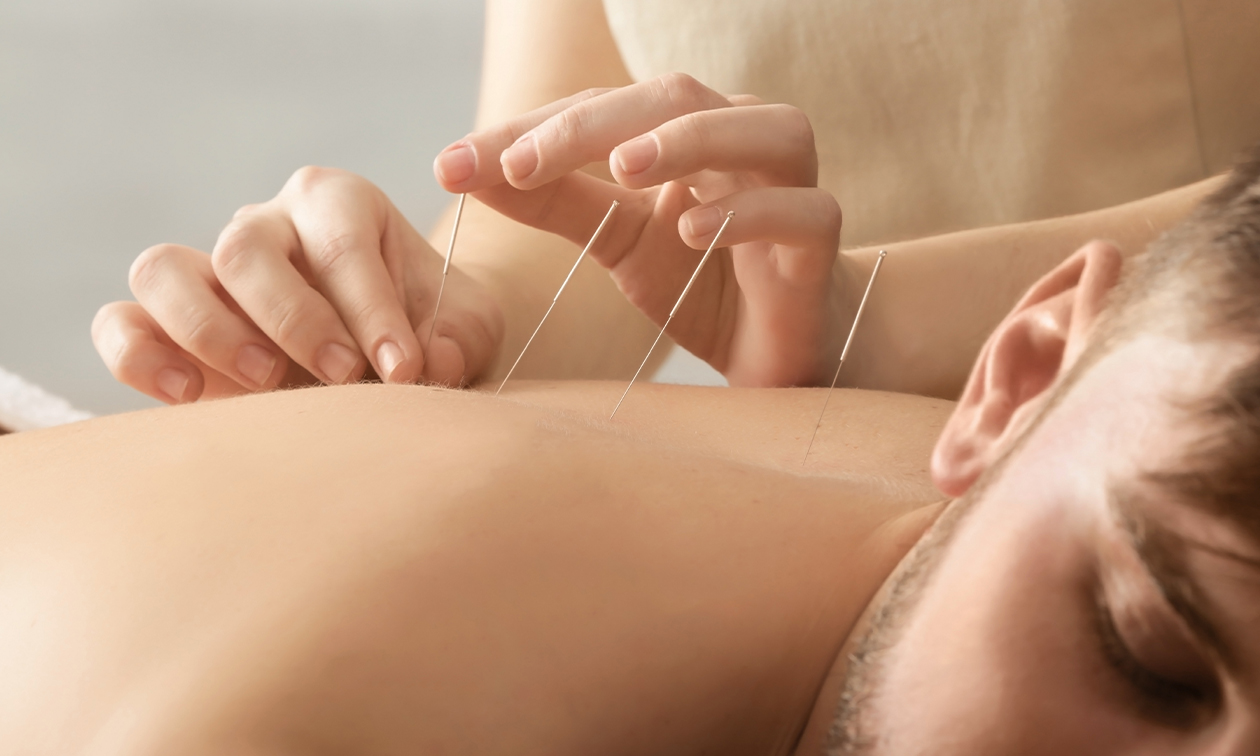 Acupunctuur Ji Shan Tang Haarlem
