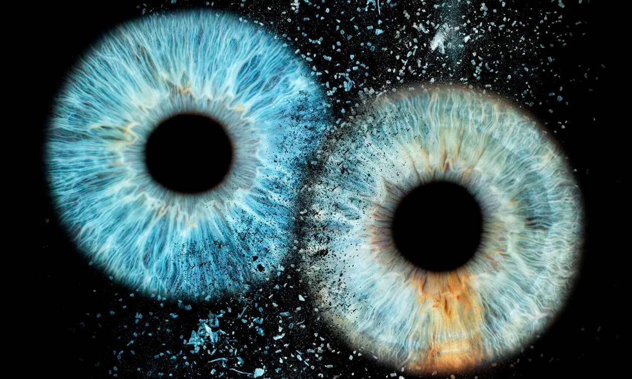 IdealEye