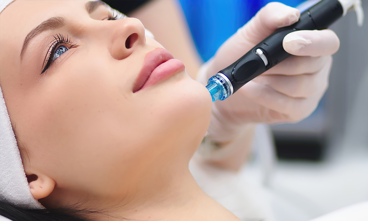 Laser Center Hoorn