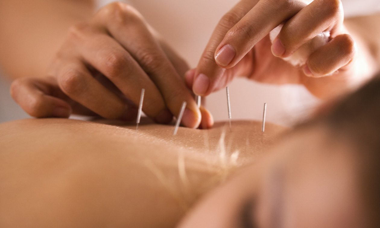 Shen Acupunctuur en Massage Studio