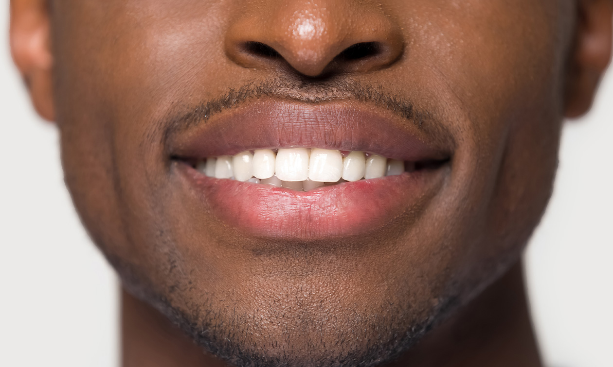 Smile to Shine