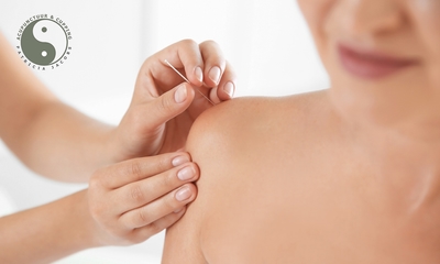 Acupunctuurbehandeling + intake (60 min)