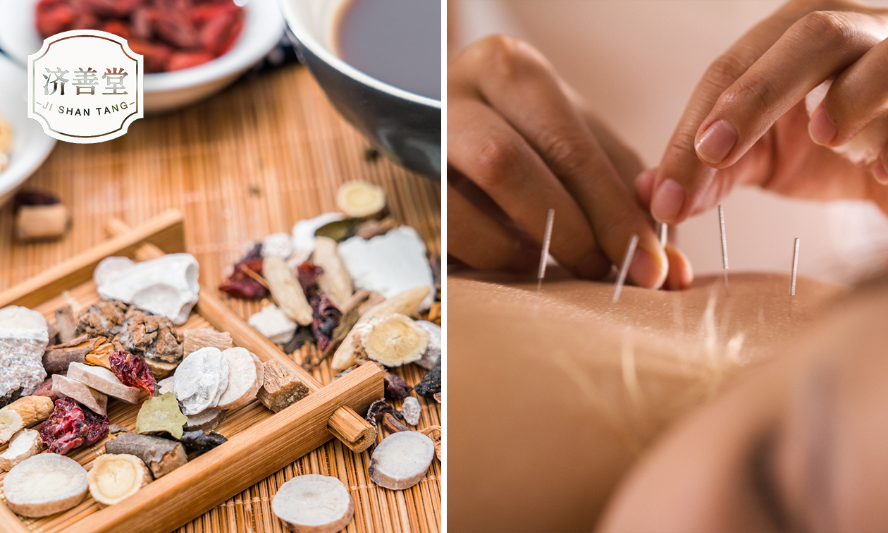 Intake + kruidenbehandeling en/of 1 of 3 keer acupunctuur (30 tot 70 min)