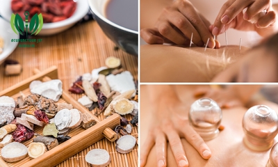 Intake + cupping, acupunctuur en/of kruidenbehandeling (30 tot 70 min)