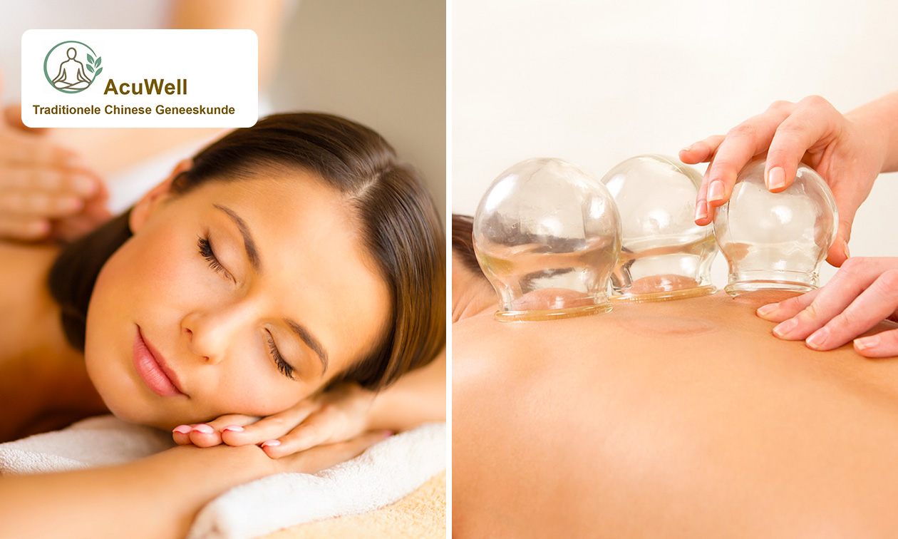 Ontspanningsmassage en/of cupping (30 of 60 min)