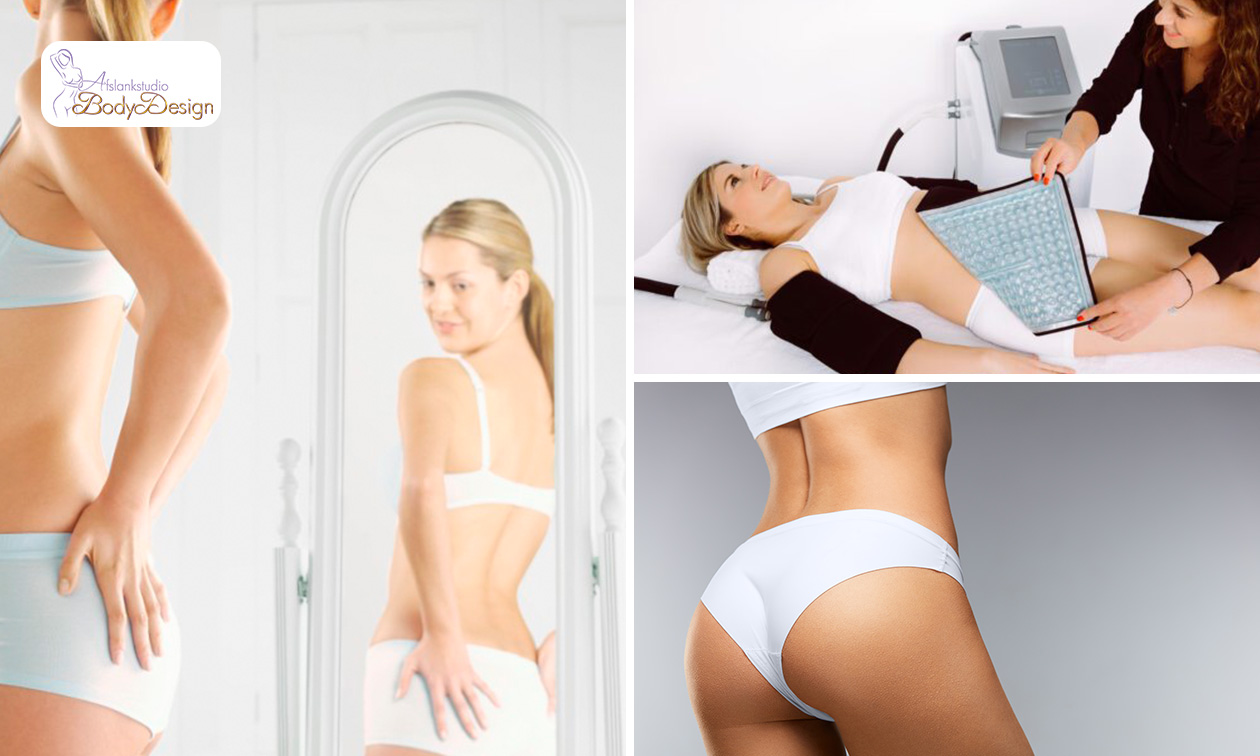 Cryolipolyse of Hypoxi VM400-VacumMassage afslankbehandeling