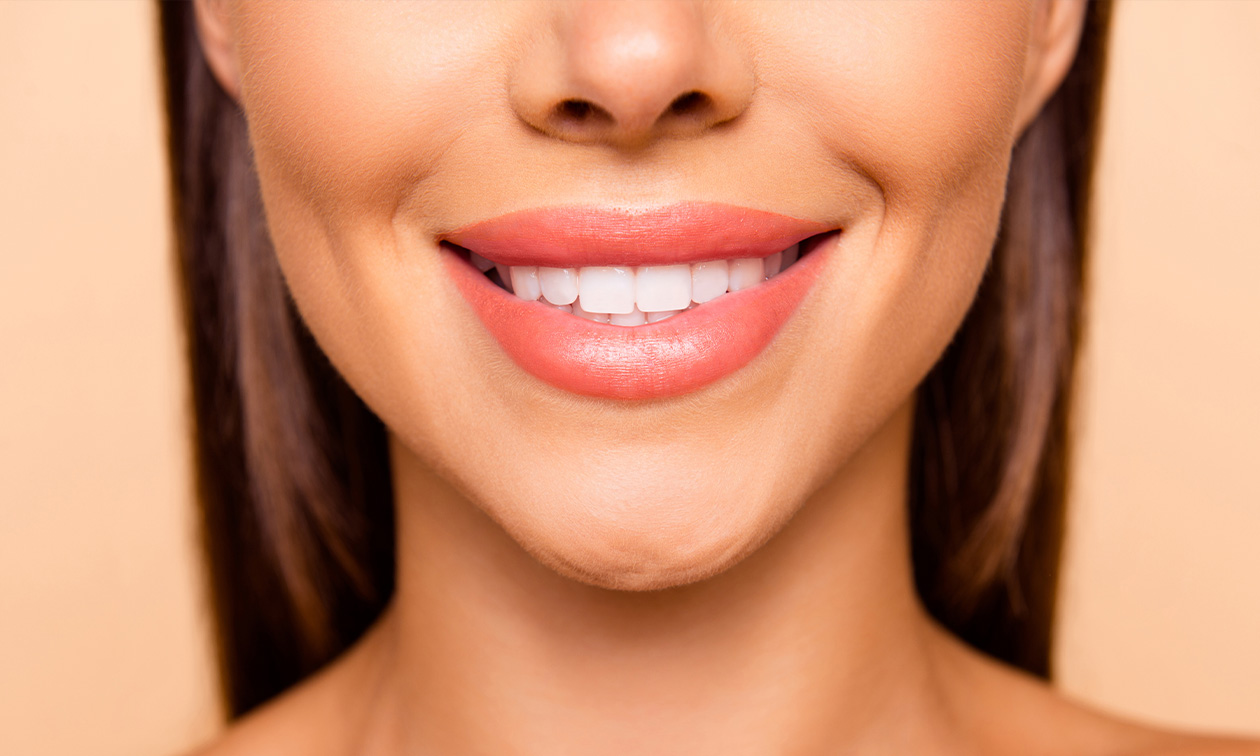 Tandenbleekbehandeling(en) naar keuze