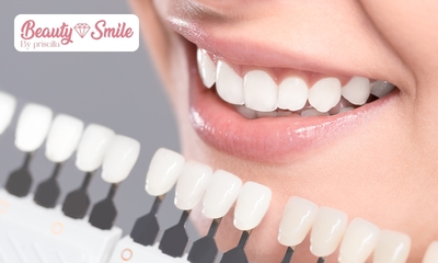 2, 4 of 6 tandenbleekbehandelingen