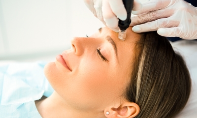 Microneedling-behandeling + led-lichttherapie (75 min)