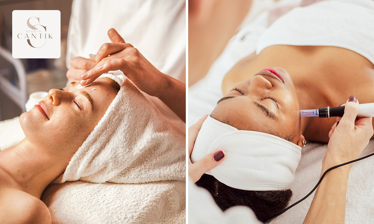 Gezichtsbehandeling of microneedling (60 min)
