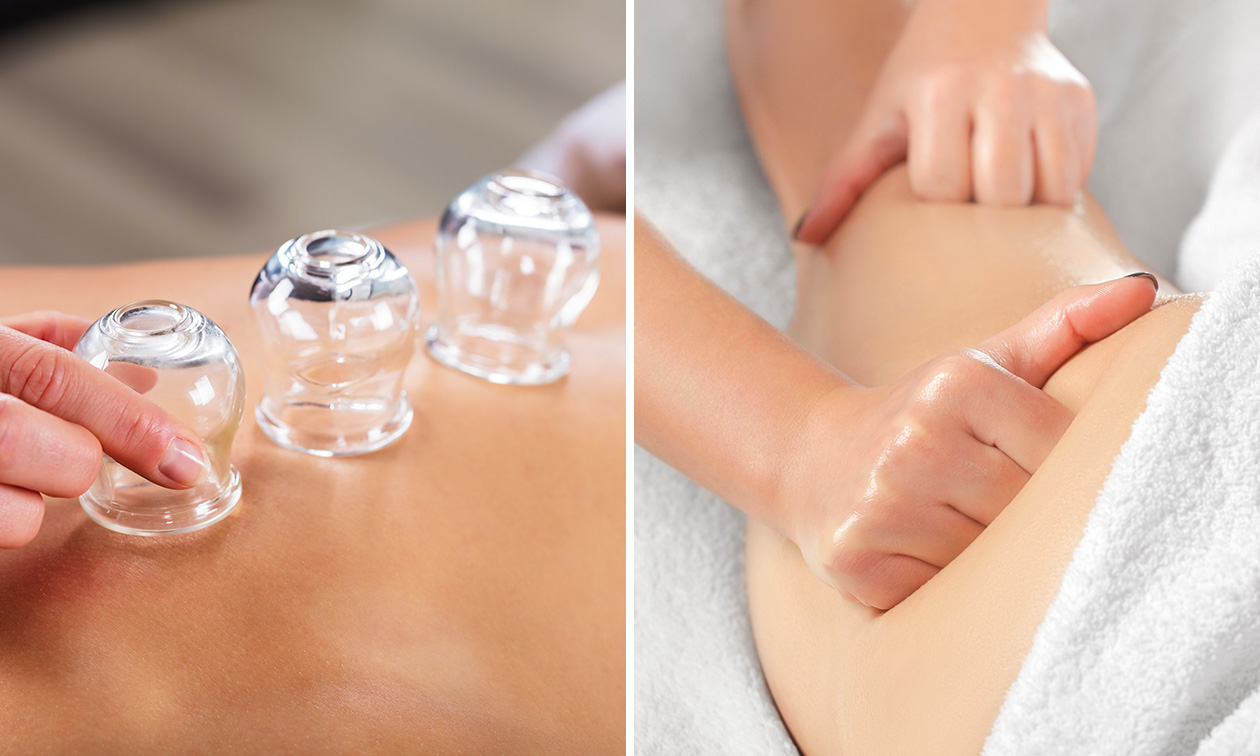 Cuppingmassage naar keuze of bindweefselmassage (45 of 60 min)