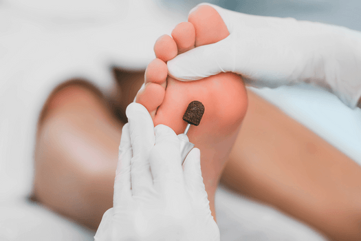 Plejende fodbehandling
