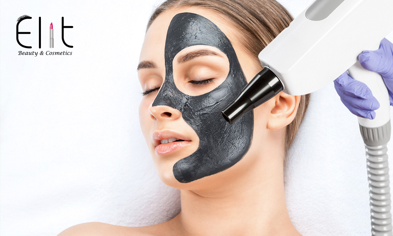 Carbon laser peeling-behandeling