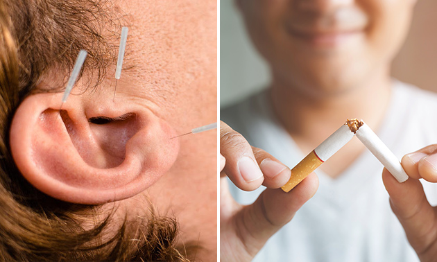 Hulp bij stoppen met roken met 1 sessie oor-acupunctuur