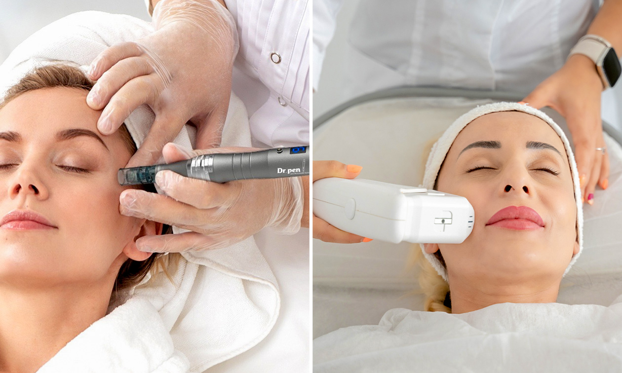 1 oder 3 Microneedling- oder HIFU-Behandlung(en) für einen Bereich nach Wahl