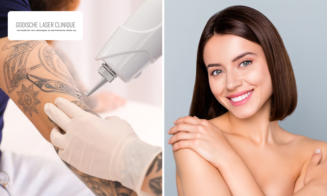 6 laser-ontharingsbehandelingen, carbon peeling of tattoo verwijderen