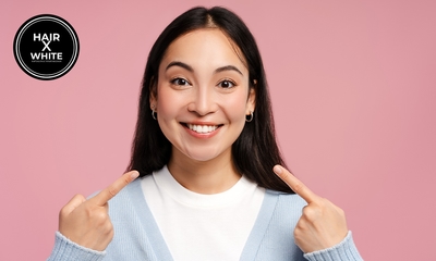 3, 4, 5 of 6 tandenbleekbehandelingen naar keuze (20 min)
