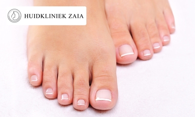 1 of 3 kalknagelbehandelingen voor 10 nagels inclusief manicurebehandeling