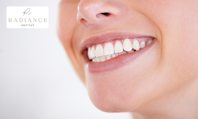 Séance de blanchiment dentaire (40 min) près de Liège