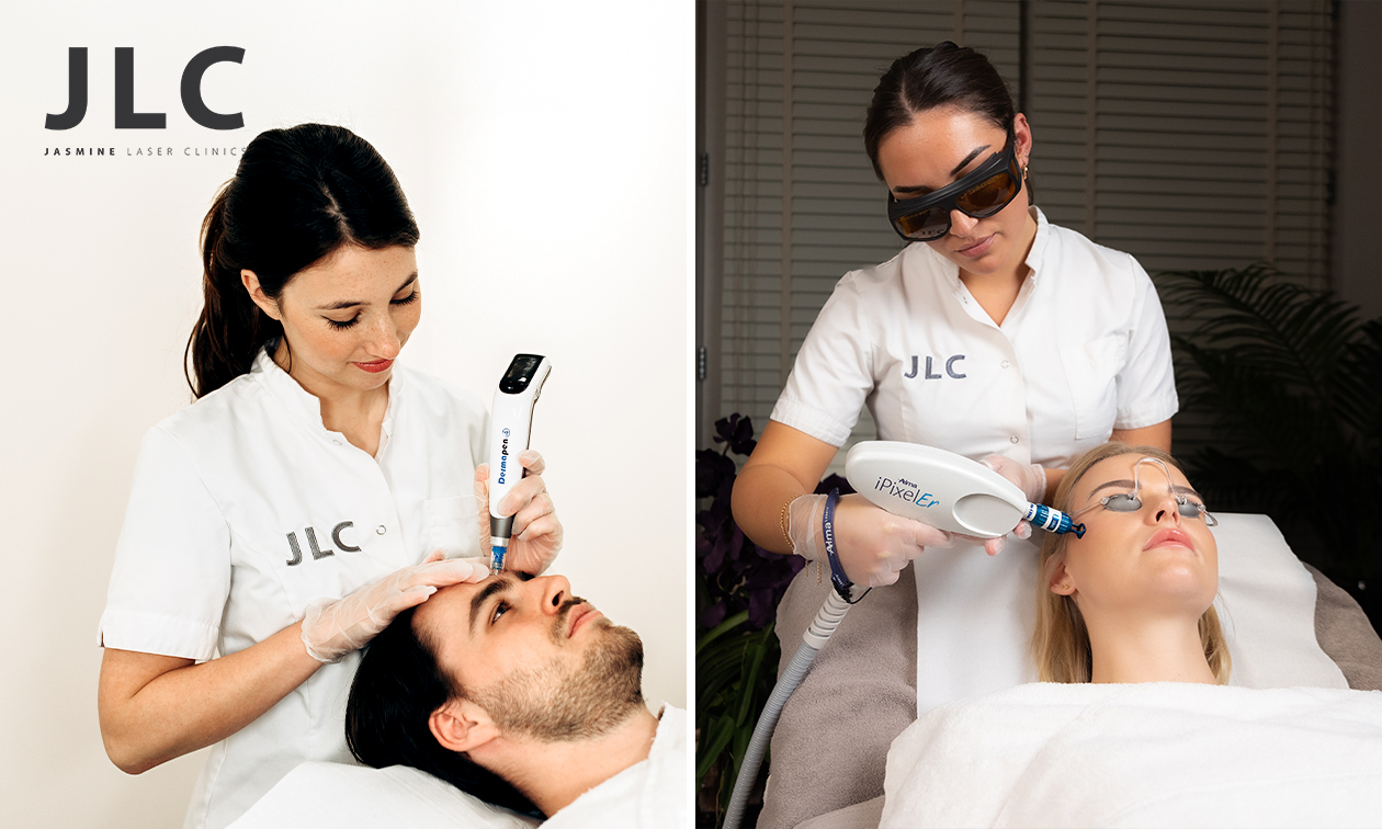 Microneedling voor zone naar keuze + evt. laserbehandeling