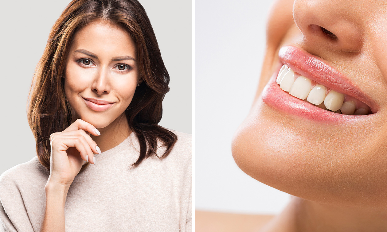 Tandenbleken of aqua facial-gezichtsbehandeling naar keuze (45 of 75 min)