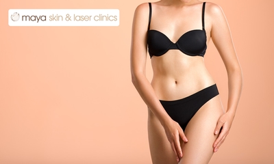 Cryolipolyse-afslankbehandeling voor 1 of 2 zones naar keuze