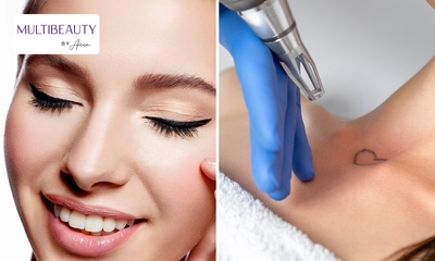 PMU naar keuze laten zetten of PMU of tatoeage laten verwijderen