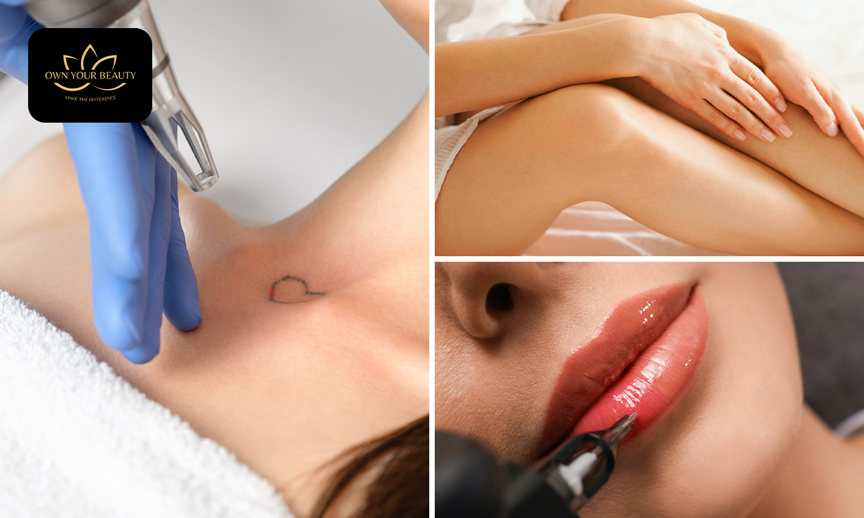 Carbon laser peeling, PMU-correctie of tatoeage verwijderen
