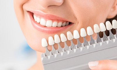 Tandenbleekbehandeling