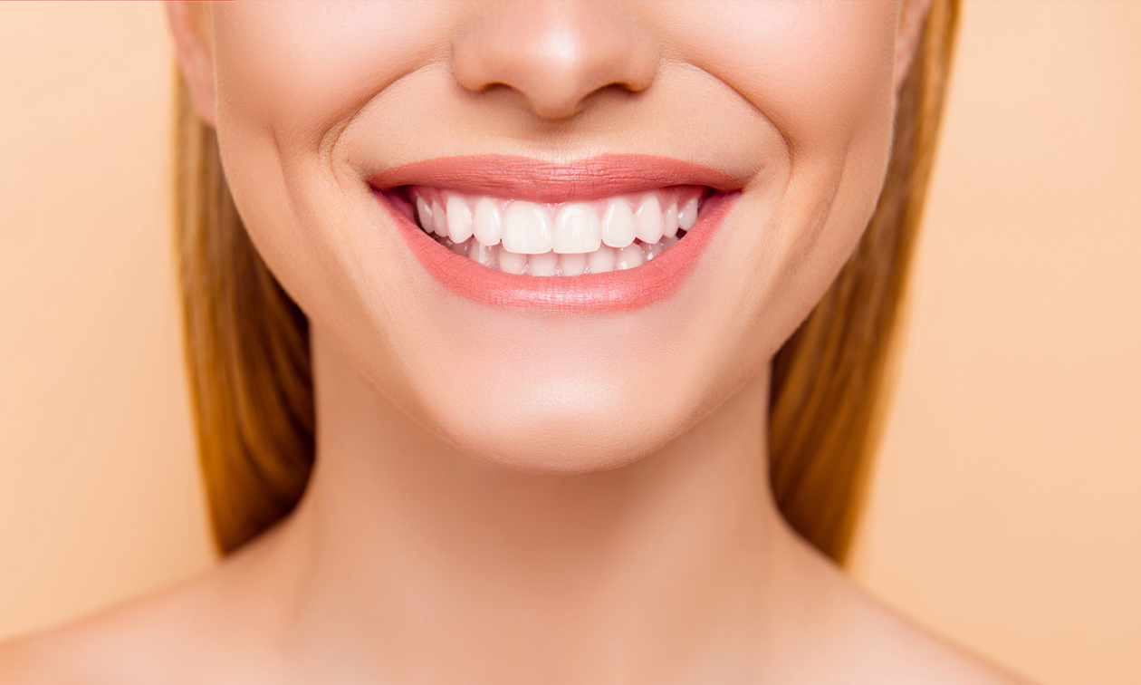 Séance de blanchiment dentaire (2 x 20 min) à Liège