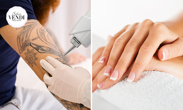 Manicurebehandeling of tatoeage verwijderen