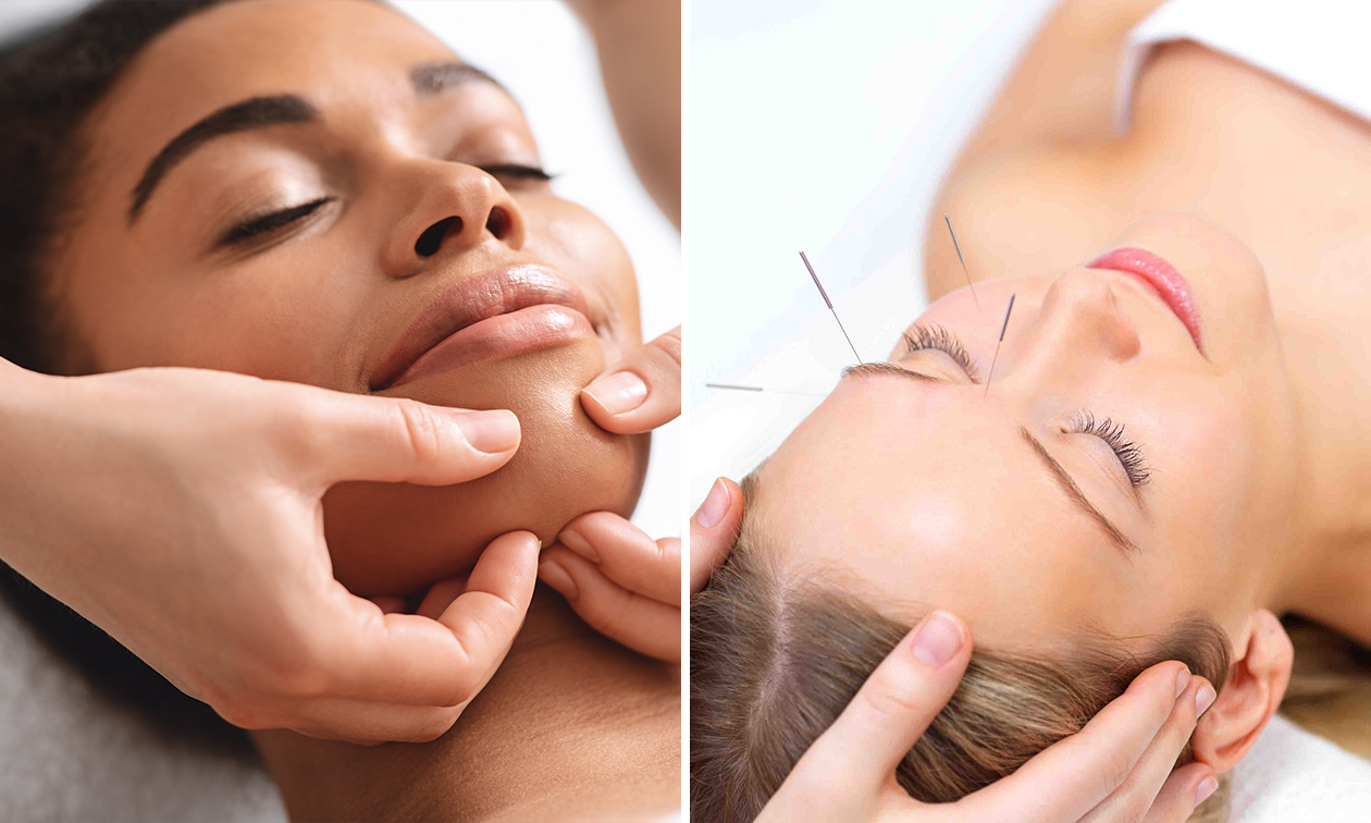 Massage naar keuze of acupunctuursessie(s)