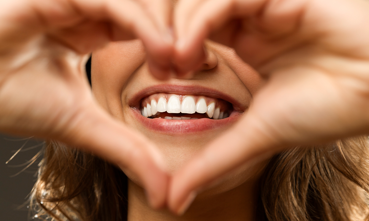 Tandenbleekbehandeling (40 of 60 min)