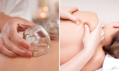 1 of 6 cupping- of bindweefselmassage(s)