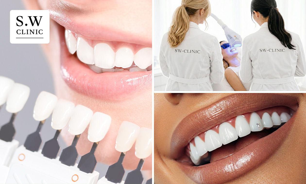 3 tandenbleekbehandelingen (20 min) + evt. polijsten of tanddiamant