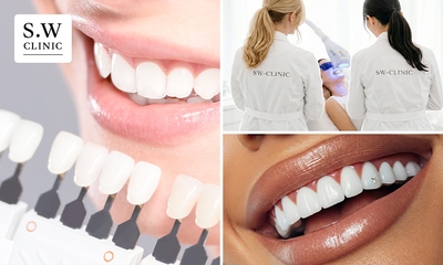 3 tandenbleekbehandelingen (20 min) + evt. polijsten of tanddiamant