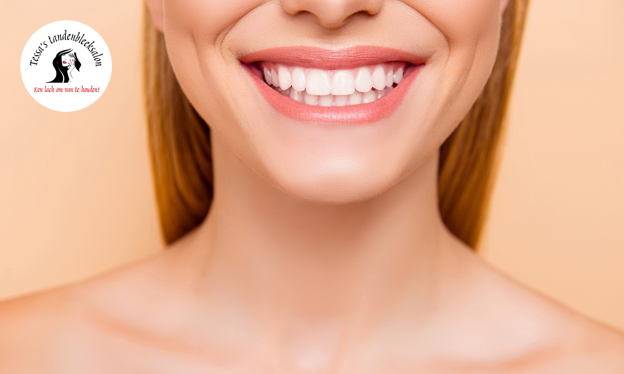 1 of 2 tandenbleekbehandeling(en) óf tandkristal
