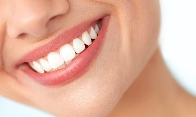 Séance de blanchiment dentaire américain (60 min) à Sambreville