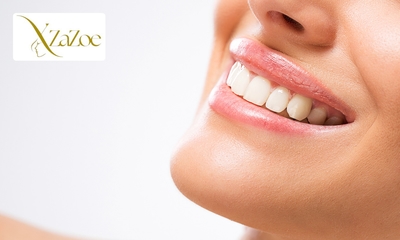 Tandenbleekbehandeling naar keuze of polijsten