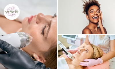 HIFU-behandeling of RF-microneedling voor zone naar keuze