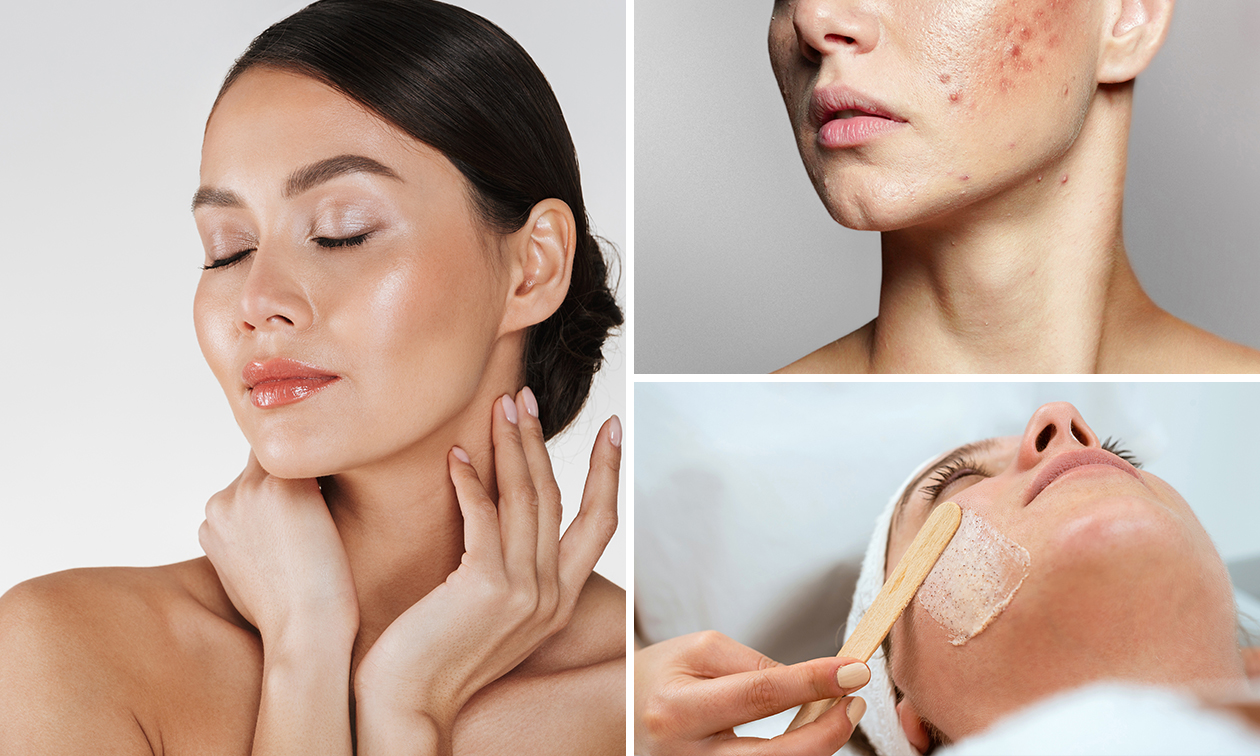 Gezichts- of acnebehandeling naar keuze (45 of 60 min)